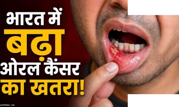 भारत में ओरल कैंसर बढ़ रहा है ICMR चेतावनी