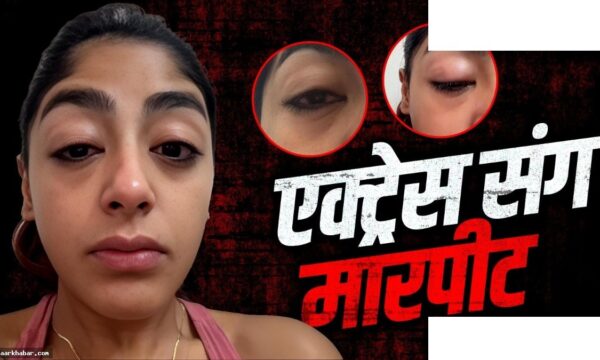 प्रीत सिंह को क्लब में हिंसक हमला, दांत टूटा