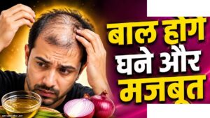 प्याज का रस से बालों का झड़ना रोकें - जावेद हबीब का नुस्खा